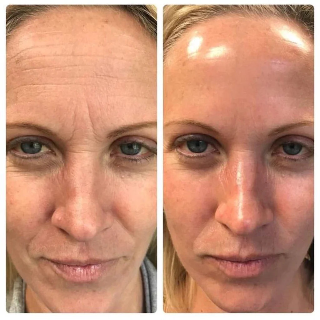 Celimax™ Retinol | Reduce arrugas sin irritar tu piel (aunque tengas piel sensible)
