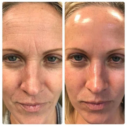 Celimax™ Retinol | Reduce arrugas sin irritar tu piel (aunque tengas piel sensible)