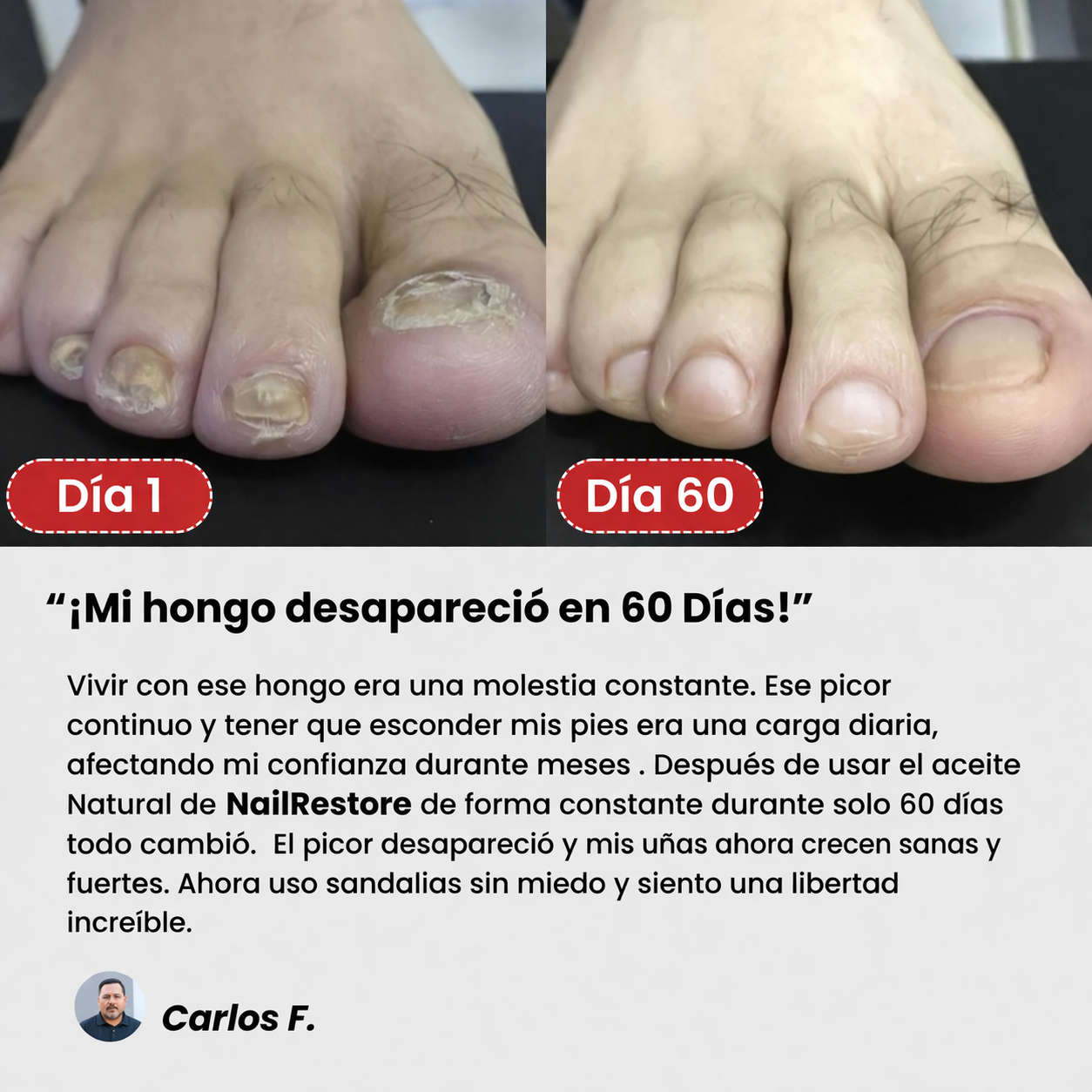 NailRestore™ | Elimina el Hongo y Recupera tus Uñas