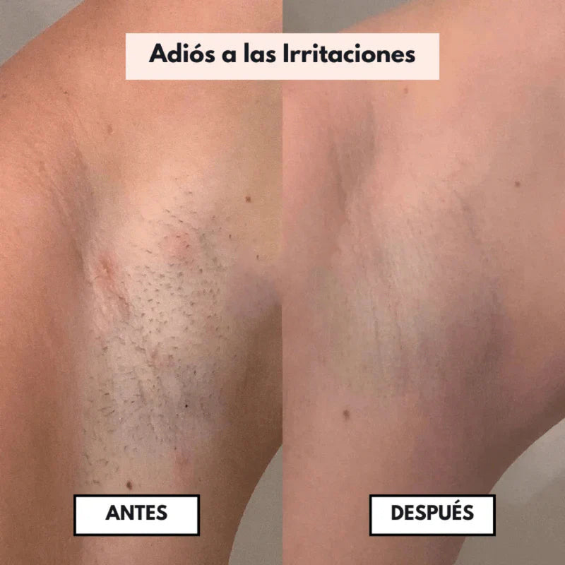DepilaPro™ 2.0 | Depílate SIN miedo, sin cortes y sin irritación (incluso en zona íntima)
