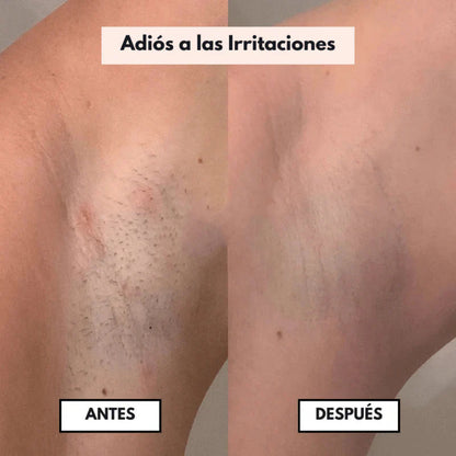 DepilaPro™ 2.0 | Depílate SIN miedo, sin cortes y sin irritación (incluso en zona íntima)