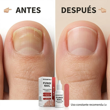 NailRestore™ | Elimina el Hongo y Recupera tus Uñas